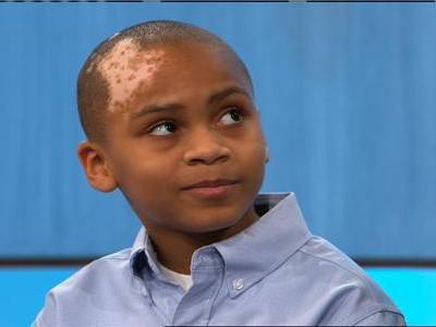 男性患者的白癜风病因有哪些