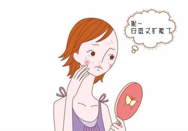 面部白点癜风需要如何治疗呢